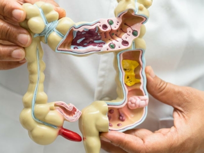 test microbiota intestinale